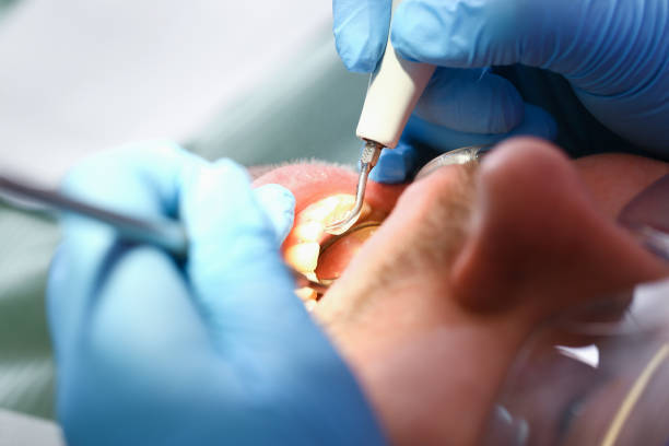 Best Dentist for Tooth Abscess  in Scandia, MN